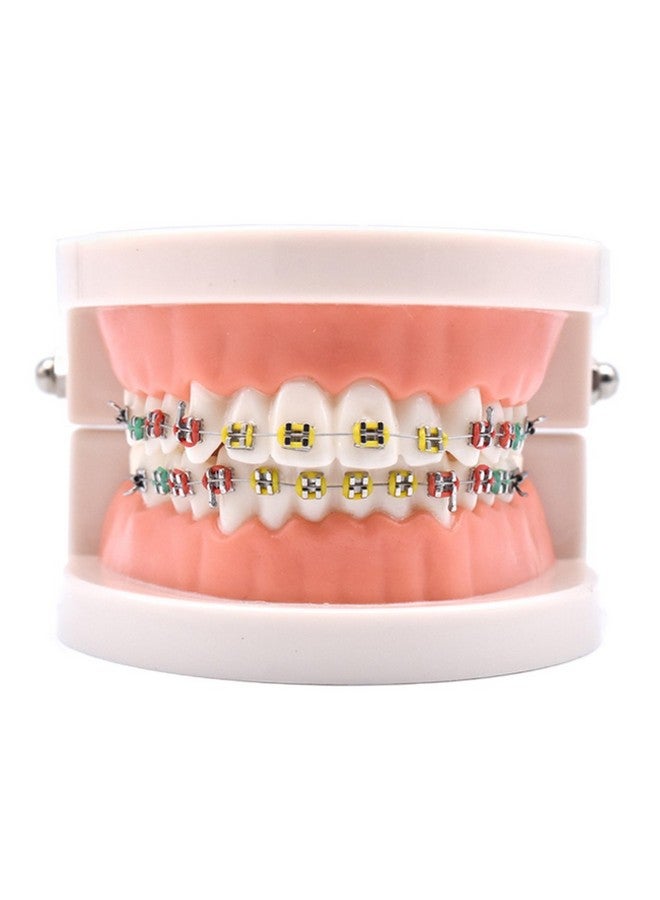 1 Piece Dental Demonstration Orthodontic Model With Metal Wires And Bracket (Metal Bracket)