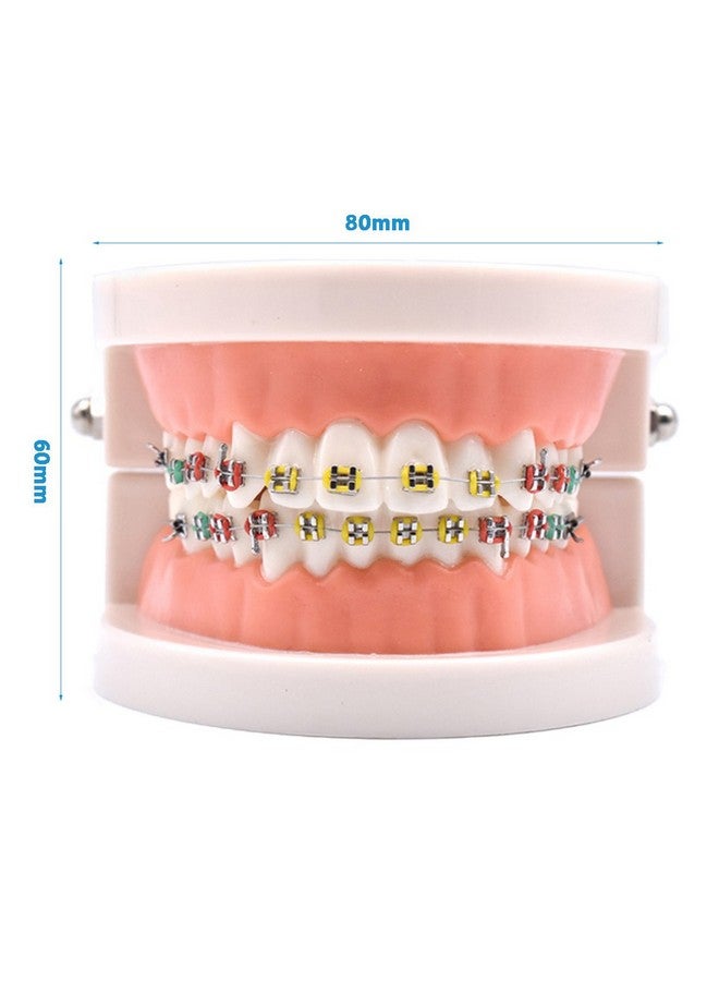 1 Piece Dental Demonstration Orthodontic Model With Metal Wires And Bracket (Metal Bracket)