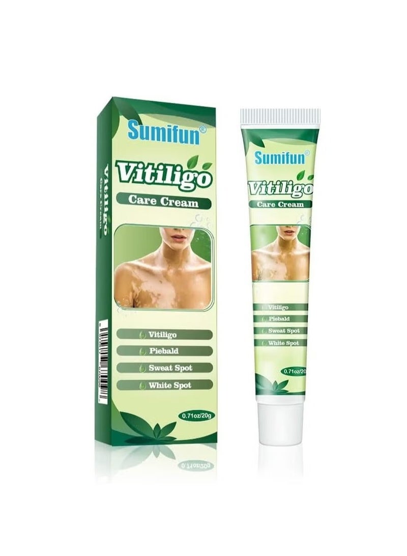 Vitiligo Care Cream, Natural Herbal Formula Anti Vitiligo Cream, Moisturizing White Spots Remover Cream, Fast Absorption Effective Vitiligo Care Cream For Skin Vitiligo, Psoriasis, Leukoplakia