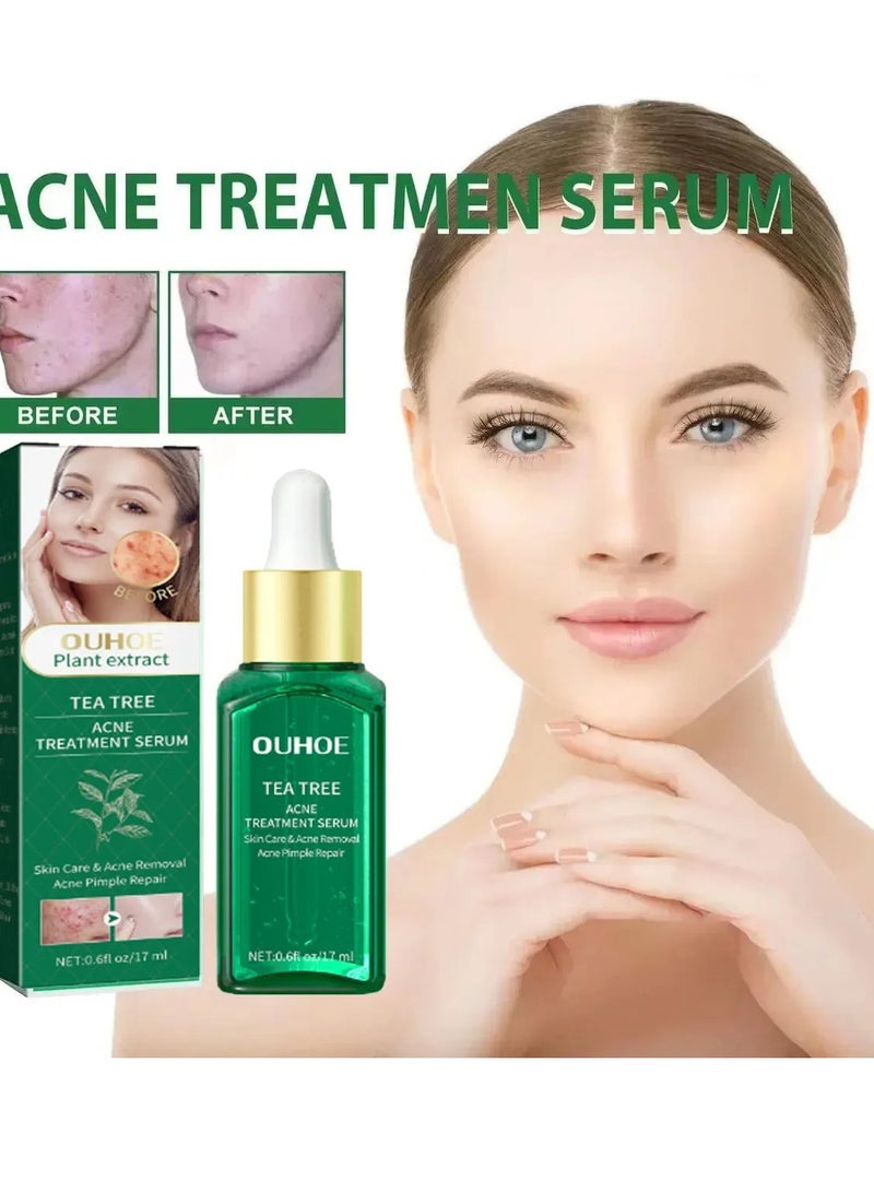 Acne Treatment Serum, Anti Ageing Pore Shrinking Skin Care Essence, Facial Repair Moisturizing Essence, Pimple Spots Remover Tea Tree Serum For Dark Spots Acne Pimples, Green