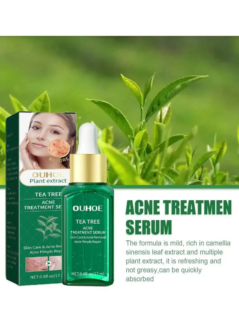 Acne Treatment Serum, Anti Ageing Pore Shrinking Skin Care Essence, Facial Repair Moisturizing Essence, Pimple Spots Remover Tea Tree Serum For Dark Spots Acne Pimples, Green