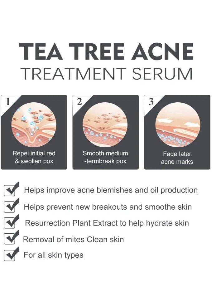 30ml Acne Treatment Serum, Anti Acne Pores Shrink 2 Percent BHA Liquid Salicylic Acid Skin Rejuvenation Essence, Facial Exfoliant For Blackheads, Enlarged Pores, Wrinkles And Fine Lines