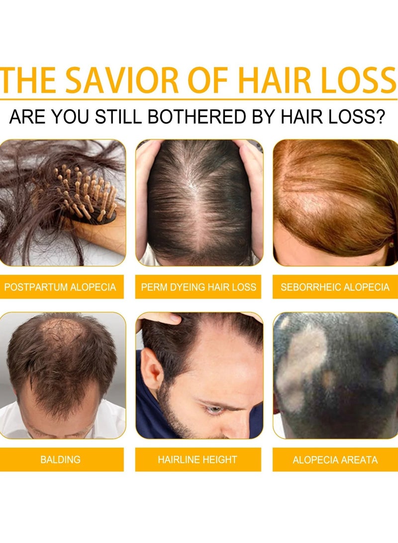 Hair Growth Spray, Biotin Thickening Herbal Serum, Anti-hair Loss Hair Care Oil, Fast Hair Growth Biotin Herbal Serum For Thicker Longer And Stronger Hair, (1pc 30ml)