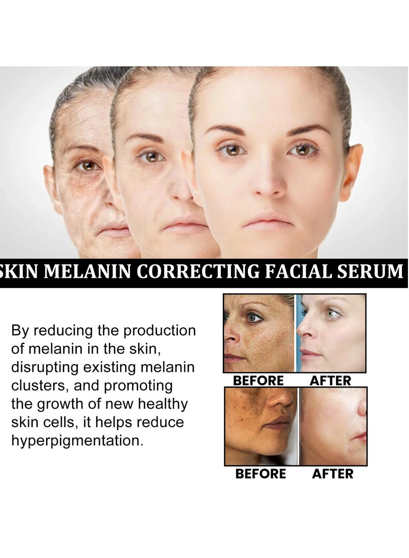 Melanin Correcting Facial Serum, Dark Spot Correcting Glow Serum, Anti-aging Facial Serum, Whitening Niacinamide Facial Essence For Skin Brightness, Dark Spot Removal And Moisturizing Skin