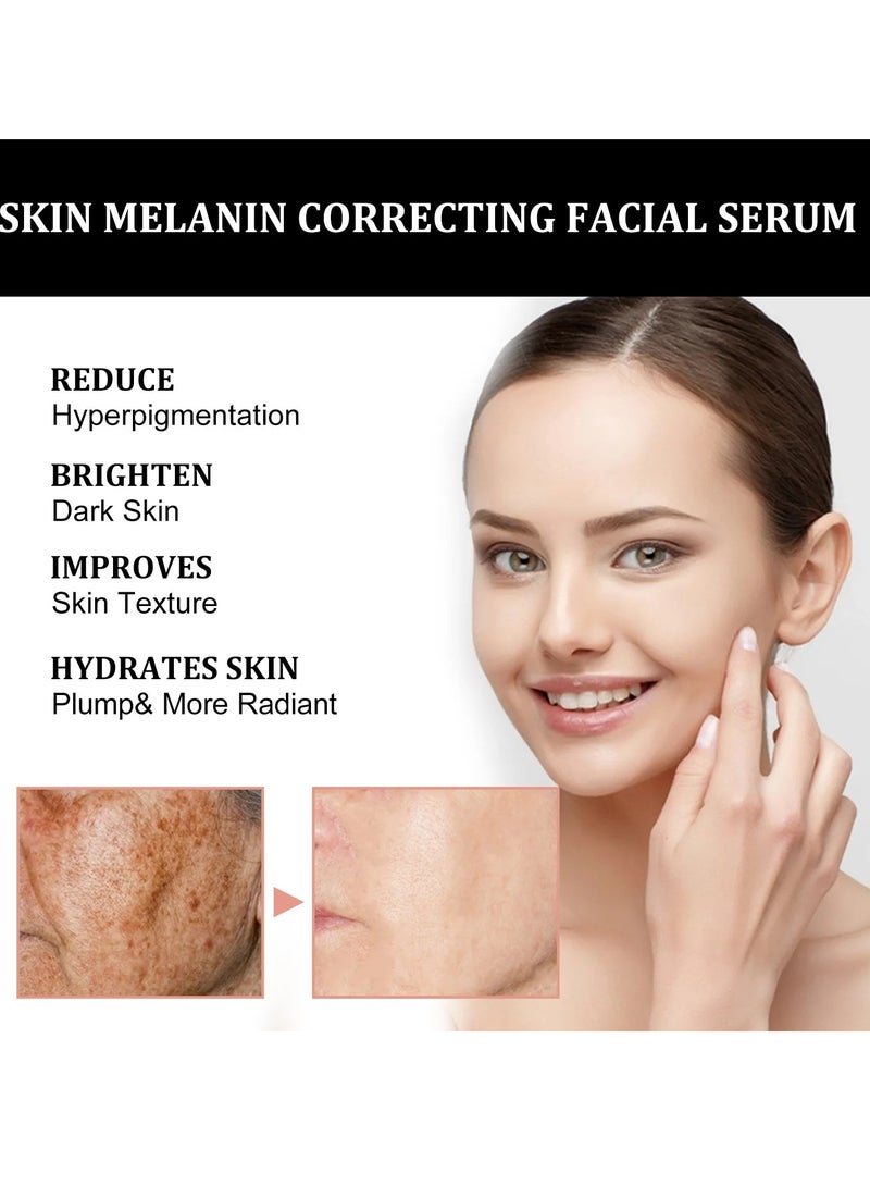 Melanin Correcting Facial Serum, Dark Spot Correcting Glow Serum, Anti-aging Facial Serum, Whitening Niacinamide Facial Essence For Skin Brightness, Dark Spot Removal And Moisturizing Skin