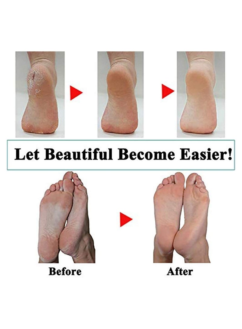 Electronic Foot File Replacement Roller, 5 Pcs Pedicure Hard Skin Remover Refills, Foot Care Tools, Coarse Replacement Roller