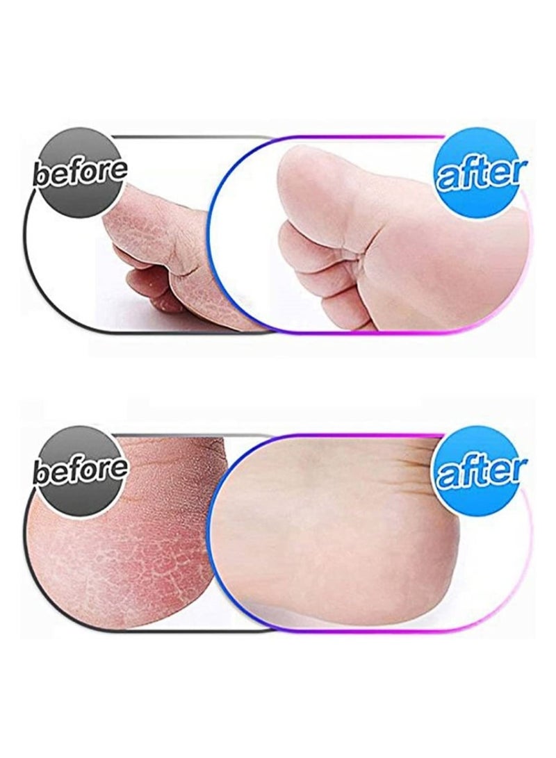 Electronic Foot File Replacement Roller, 5 Pcs Pedicure Hard Skin Remover Refills, Foot Care Tools, Coarse Replacement Roller