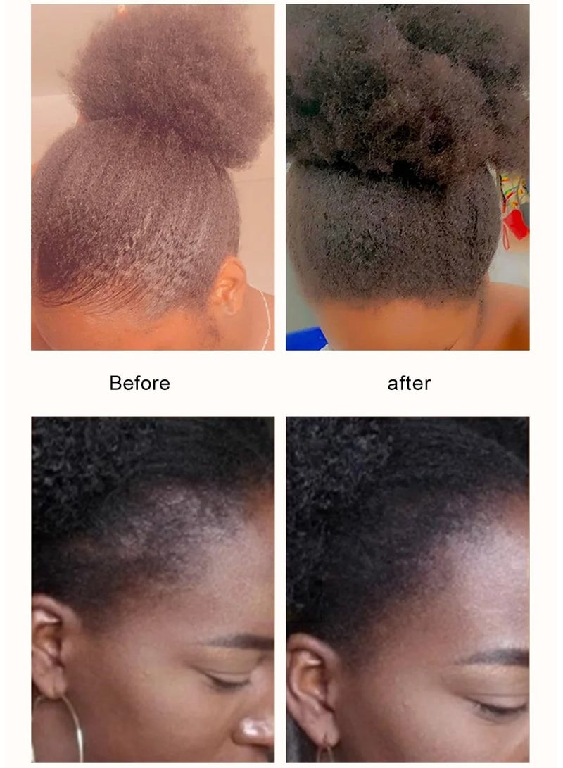 Natural Chebe Hair Shampoo, 100% Natural Hair Growth Conditioner, Anti Hair Loss Chebe Hair Serum, Chebe Traction Alopecia Thicken Shampoo To Repair Damaged Hair, (Hair Shampoo+Hair Conditioner)