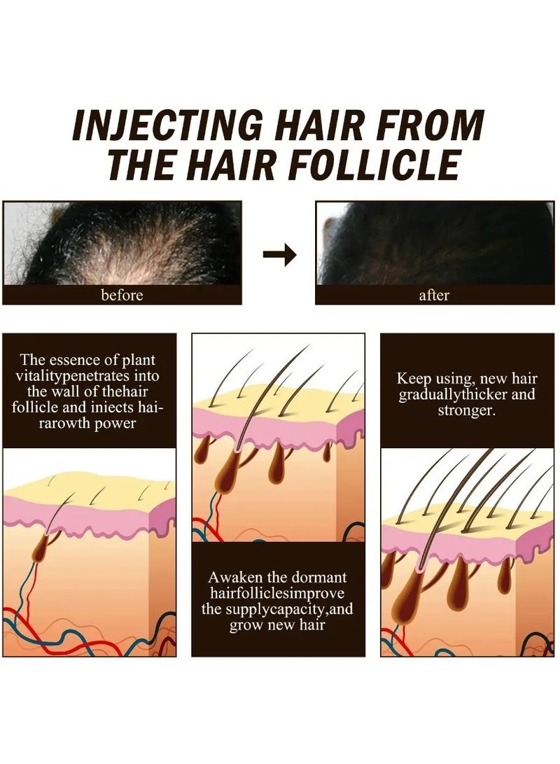 Hair Growth Serum, Anti Hair Loss Hair Growth Spray, Natural Accelerate Hair Growth Oil, Nourishing Fast Hair Grower Essence For Men And Women