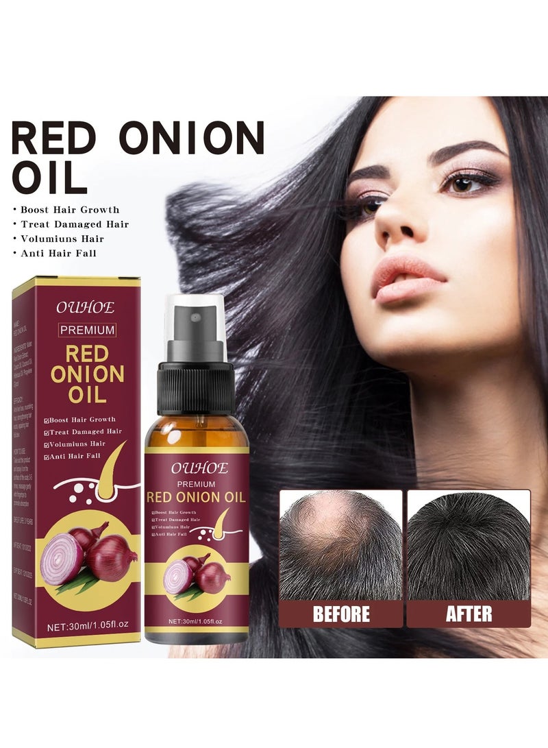Onion Hair Thickening Spray, 30ml Hair Growth Onion Oil, Moisturizing Scalp Anti Hairs Loss Treatment Essence, Nourishing Hair Growth Serum Spray For Men Women