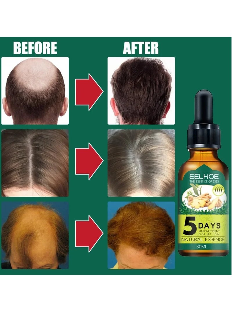 Ginger Fast Hair Growth Oil, 30ml Nourishing Essential Oil For Hair Care, Anti Hair Loss Natural Essence Oil, Head Hair Essence Serum For Hair Thicking Hair Growth, Treating Baldness