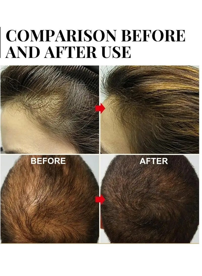 Batana Oil For Hair Growth, Natural And Safe Nourishing Hair Care Oil,  Moisturizing Batana Oil Butter For Hair Loss Treatments, Organic Hair Growth Essence For All Hair Types, (B 20ml)