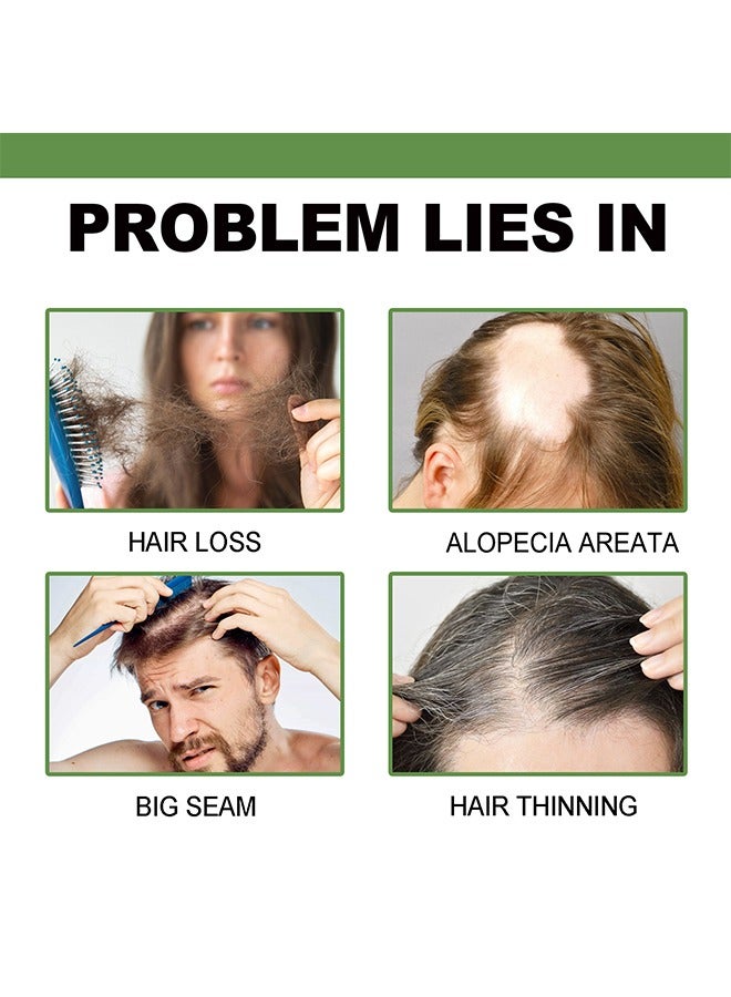 Hair Lotion ,Hair Treatment Hair Growth Serum Hair Lotion ,Hair Loss Treatments, Aids against Hair-thining, Hair Regrowth Treatment 120ml