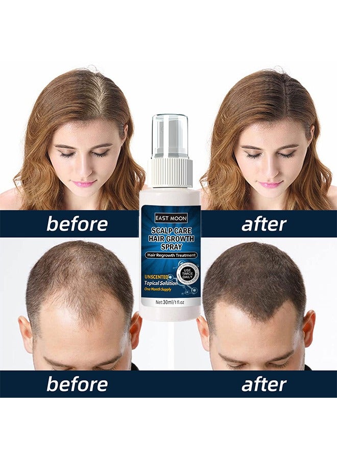 Scalp Care Hair Growth Spray-Ultra Hair Growth Formula Serum Spray, Grow Thicker Hair In 8 Weeks-30ML