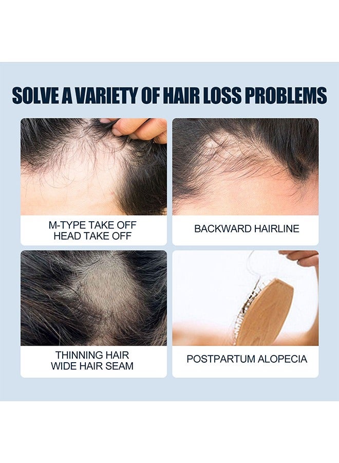 Scalp Care Hair Growth Spray-Ultra Hair Growth Formula Serum Spray, Grow Thicker Hair In 8 Weeks-30ML