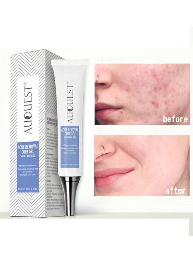 Acne Remoyal Gure Gel -Herbal Acne Treatment Cream Pimple Spot Removal for Teens Oil Control Acne Scar Gel Shrink Pores Skin Care Beauty Health 20g