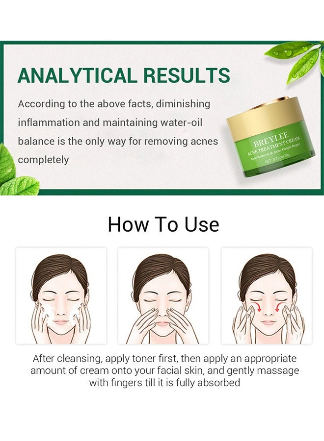 Acne Treatment Ceam Acne Removal Acne Pimple Repair Cream, Acne Spot Treatment for Face & Acne Dots, Natural Cystic Acne Treatment, For All Skin Types, 20g