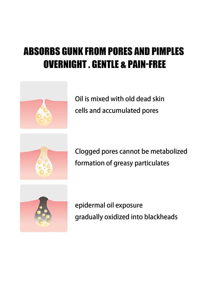 Hydrocolloid nose patche,Remove nose blackheads and pimples, clean and shrink pores with nose patches(10 PCS)