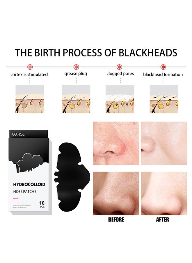 Hydrocolloid nose patche,Remove nose blackheads and pimples, clean and shrink pores with nose patches(10 PCS)