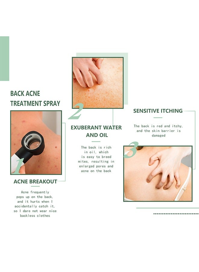 Back Acne Treatment Spray , Lighten Acne Marks Repair Back Shoulder Acne Skin,2% Salicylic Acid and Tea Tree Oil Spray 120ml