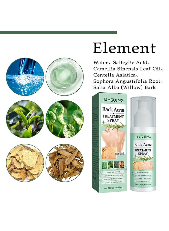 Back Acne Treatment Spray , Lighten Acne Marks Repair Back Shoulder Acne Skin,2% Salicylic Acid and Tea Tree Oil Spray 120ml