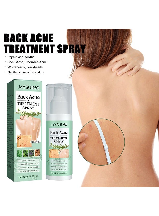 Back Acne Treatment Spray , Lighten Acne Marks Repair Back Shoulder Acne Skin,2% Salicylic Acid and Tea Tree Oil Spray 120ml