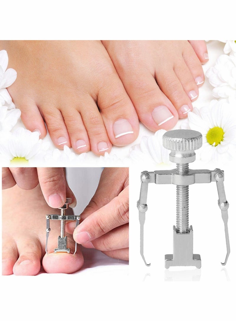 lngrown Toenail Treatment Kit, 2Pcs Professional Ingrown Toe Nail Recover Correction Tool, Pedicure Tools for Nail Correction, Softening and Easy Trimming