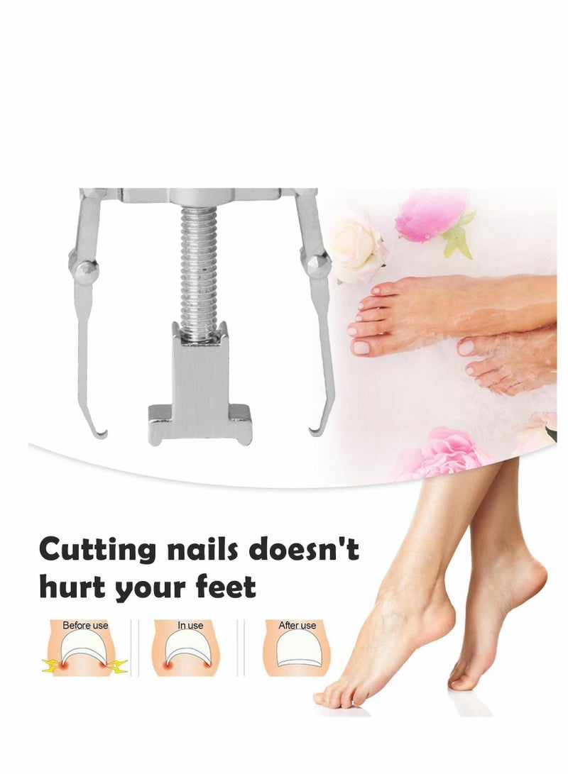 lngrown Toenail Treatment Kit, 2Pcs Professional Ingrown Toe Nail Recover Correction Tool, Pedicure Tools for Nail Correction, Softening and Easy Trimming
