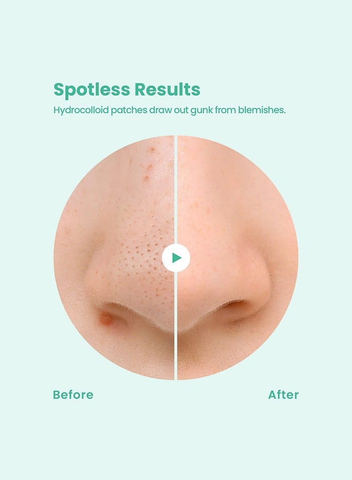GLAM UP Spotless Nose Patch Hydrocolloid