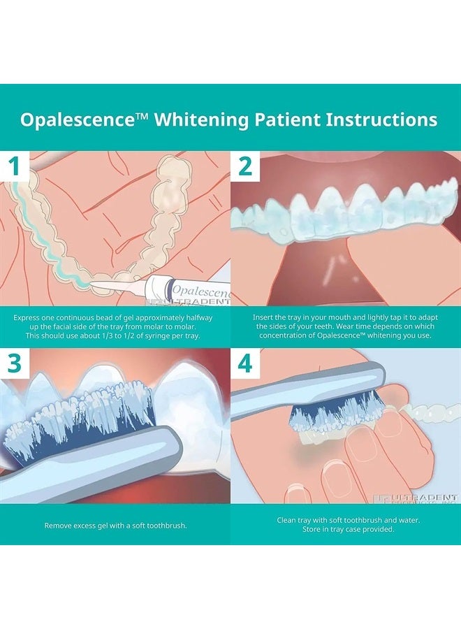 35% Gel Syringes Teeth Whitening - Refill Kit (6 Pack / 12 Syringes), Made by Ultradent, Carbamide Peroxide in Mint Flavor. Tooth Whitening 5197-12
