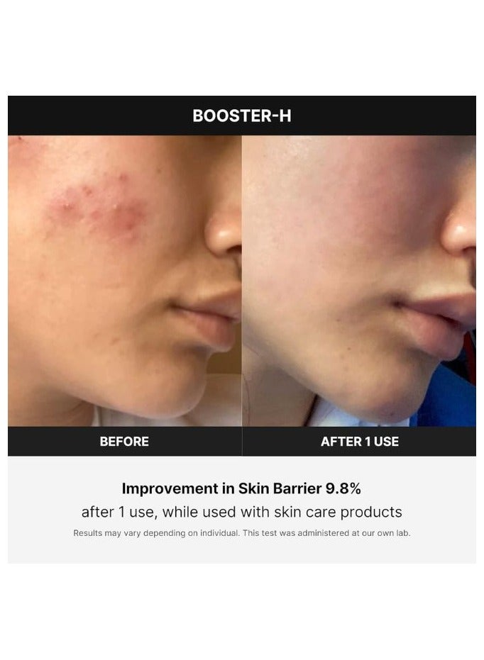 Age-R Booster H - Korean No.1 Skin Care Device, Facial Glow Booster for Maximizing and Boosting Skin Care Absorption, Needle Free
