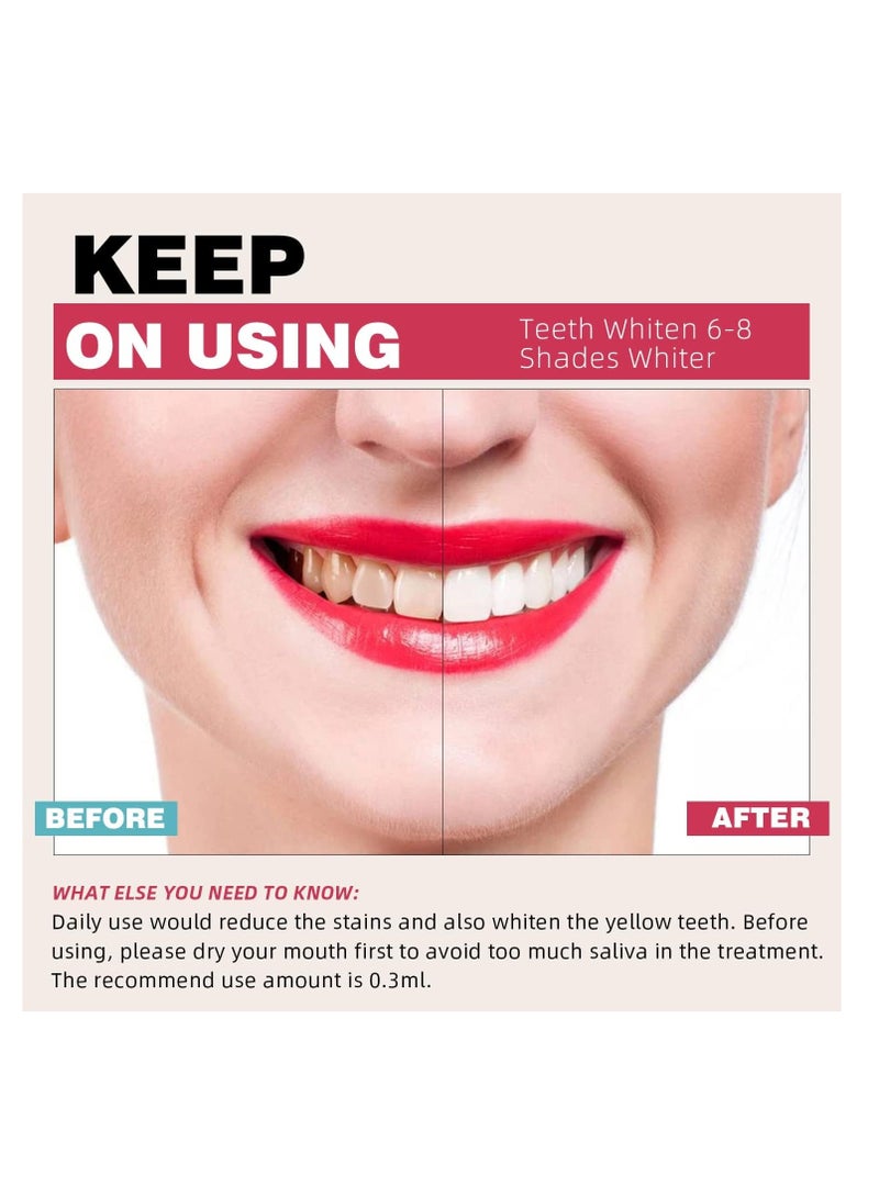 Teeth Whitening Kit with LED Lights Tray for Sensitive Teeth, 10x Whitening Pen Gel, Teeth Whitener at Home, Pain Free and Enamel Safe, Up to 1-9 Shades Whiter in 1-2 Weeks, 2-3X Faster Than Strip