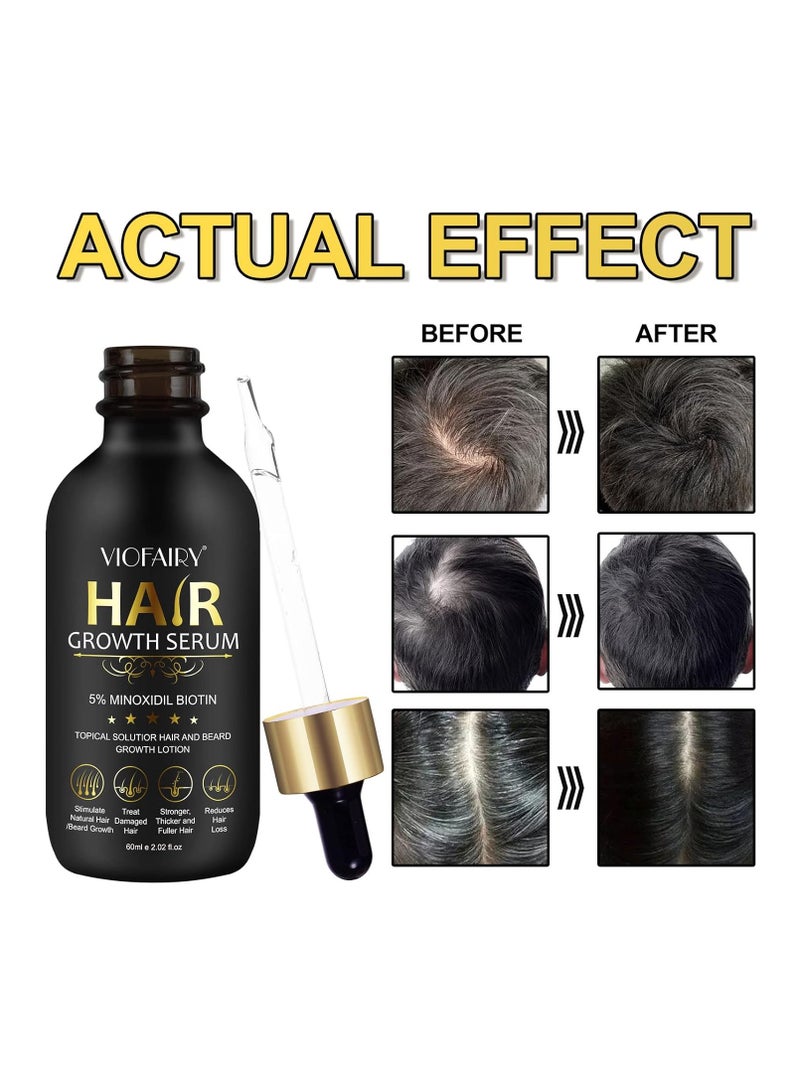 5% Minoxidil for Men and Women Hair Growth Oil, Biotin Hair Growth Serum Hair Regrowth Treatment for Scalp Hair Loss Hair Thinning, Natural Hair Growth for Thicker Longer Fuller Healthier Hair 2.02 oz