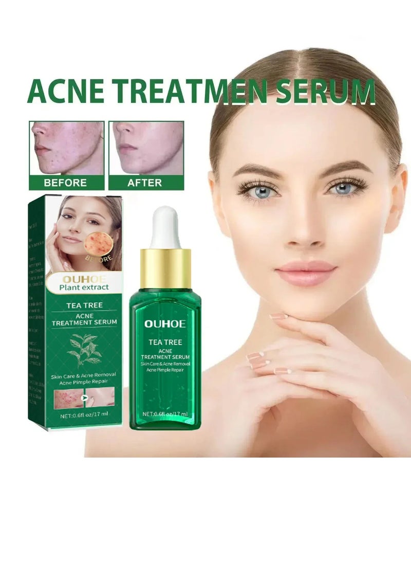 Acne Treatment Facial Serum, Natural Organic Formula Tea Tree Serum,  Fast Absorbing Moisturizing Pore Shrinking Skin Care Lotion Against Face Acne Cleaning Pimple Spots Remover