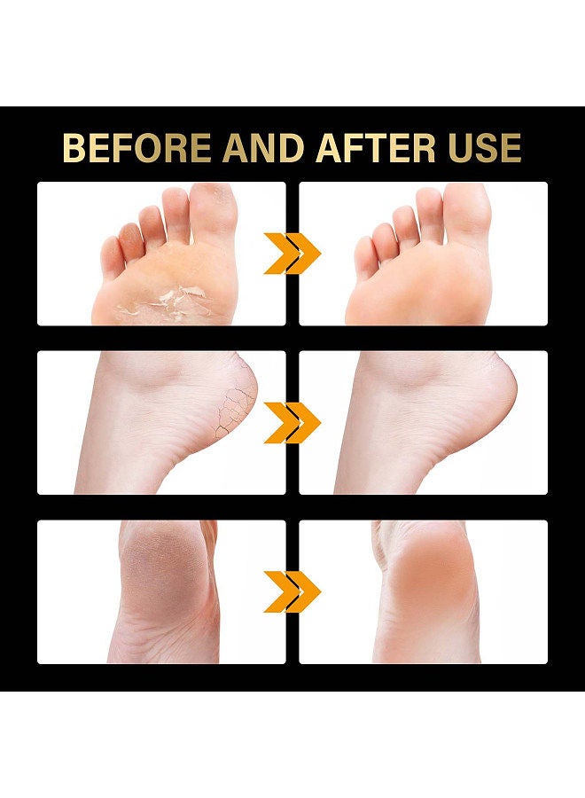Jaysuing 2 Pairs Lavender Exfoliating Foot Mask Moisturizing Hydrating Remove Dead Skin Foot Pad