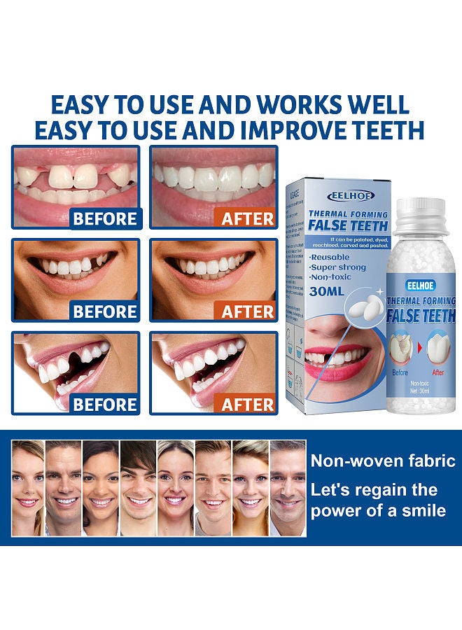 EELHOE Thermal Forming False Teeth Tooth Repair Kit Tooth Repair Granules for Missing and Broken Tooth Temporary Teeth Filling Repair Kit