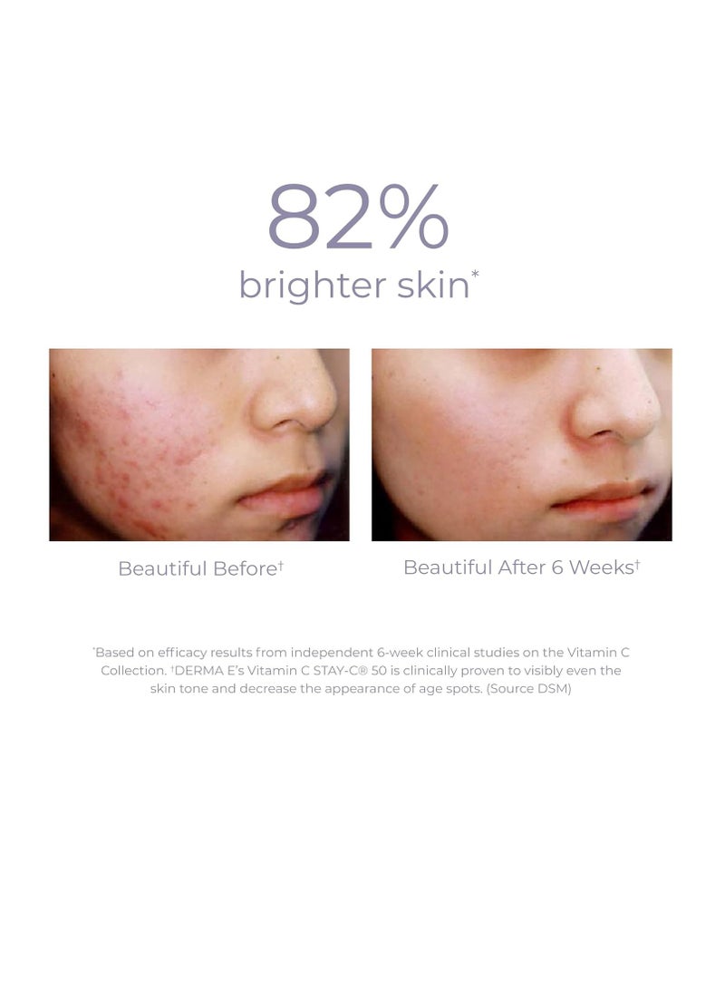 DERMA E Vitamin C Concentrated Serum with Hyaluronic Acid, Vitamin E & Aloe, All Natural, Antioxidant-Rich Concentrated Facial Serum – Firming and Brightening Vitamin C Face Serum, 2oz