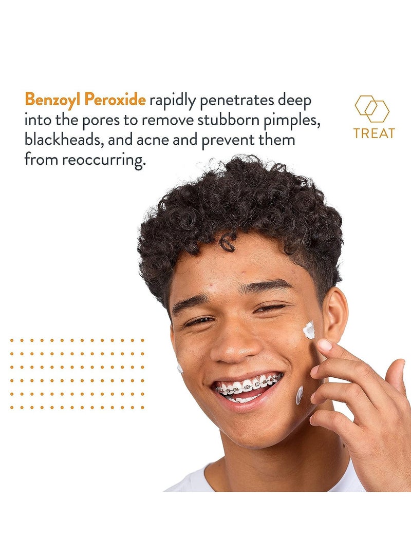 AcneFree Terminator 10 Acne Spot Treatment with Benzoyl Peroxide 10% Maximum Strength Acne Cream Treatment, 1 Ounce - Pack Of 1