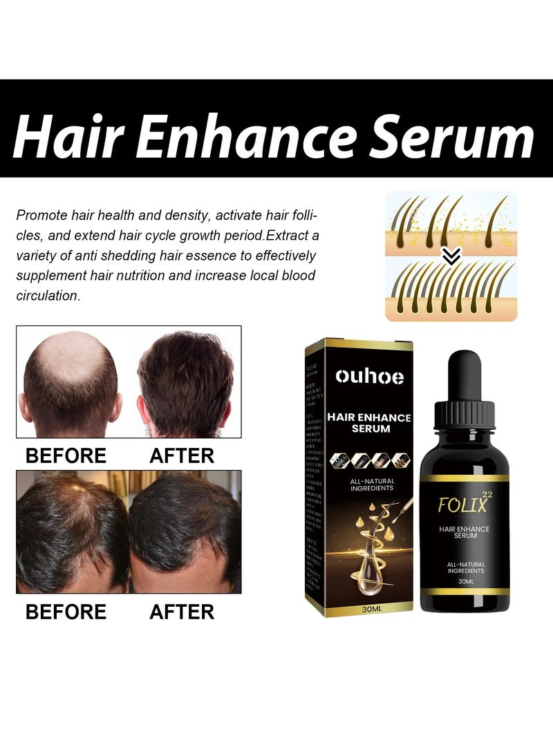 Hair Thickening Serum, Natural Ingredients Hair Growth Oil, Nourishing Hair Growth Scalp Treatment Oil,  Anti Hair Loss Hair Treatment Essence For Thinning And Damaged Hair