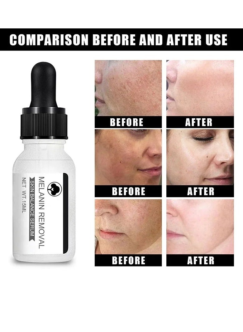 Niacinamide Serum, Face Whitening Dark Spot Corrector Serum, Whitening And Moisturizing Anti Aging Face Cream, Smooth Gentle Brightening Skin Care Serum For Skin Repairing