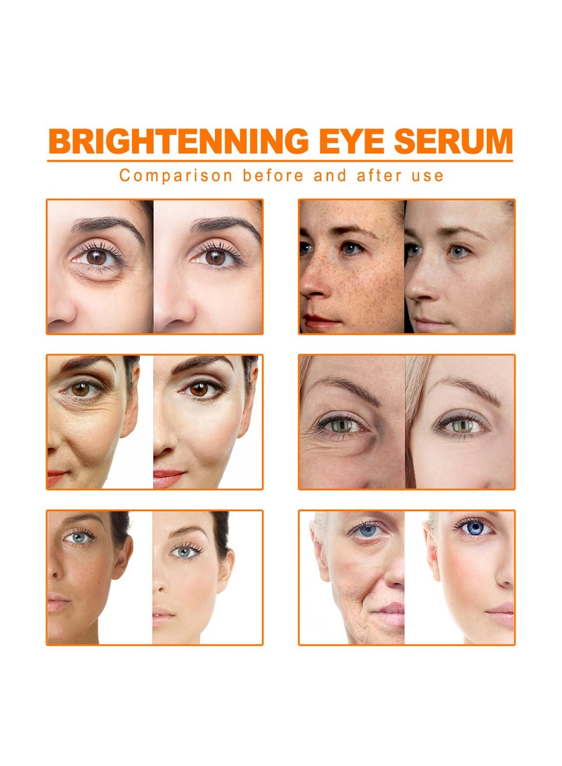 West&Month Turmeric Essential Oil Facial Skin Lightening Spot Anti-Wrinkle Lifting Skin Care Firming Moisturizing Oil