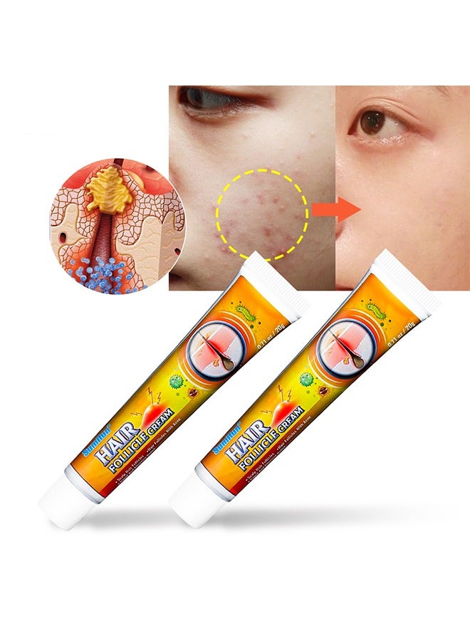 Hair Follicle cream ,Scalp Hair Follicles & Hair Follicles With Acne,Treatment for Face and body, Natural Cystic Acne Treatment, Premium Hair Follicle Cream & Pimple Remover - 20g