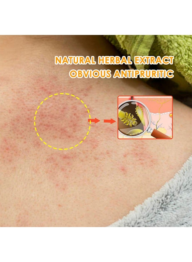 Hair Follicle cream ,Scalp Hair Follicles & Hair Follicles With Acne,Treatment for Face and body, Natural Cystic Acne Treatment, Premium Hair Follicle Cream & Pimple Remover - 20g