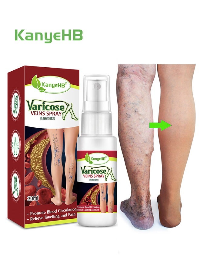 Varicose Veins Spray 30ml + Varicose Veins Cream 20g for Varicose and Spider Veins, A Pain Relief Improves Blood Circulation Helps Significantly Reduce Varicose Veins in the Legs, Body and Arms