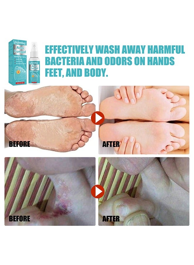 Anti Fungal Athletes Foot Spray-Anti Fungi Treatment For Feet Itchy, Sweating, Peeling And Blisters, Natural Ingredients Foot Fungi Spray For Tinea Pedis 50ML