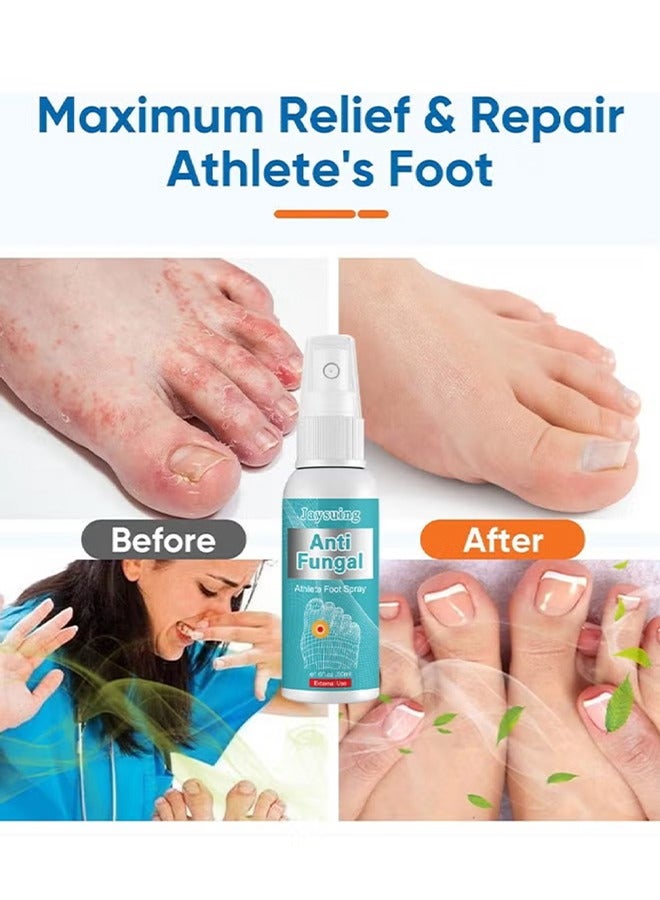 Anti Fungal Athletes Foot Spray-Anti Fungi Treatment For Feet Itchy, Sweating, Peeling And Blisters, Natural Ingredients Foot Fungi Spray For Tinea Pedis 50ML