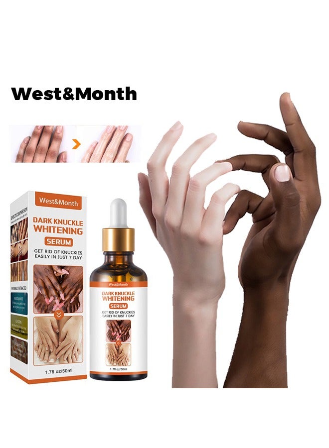 Dark Knuckle Whitening Serum-Restoring Hand Treatment, Moisturizing, Exfoliates and Reduces Unbalanced Pigmentation, for Removing Dark Knuckle Elbow, Brighter, Firmer Skin