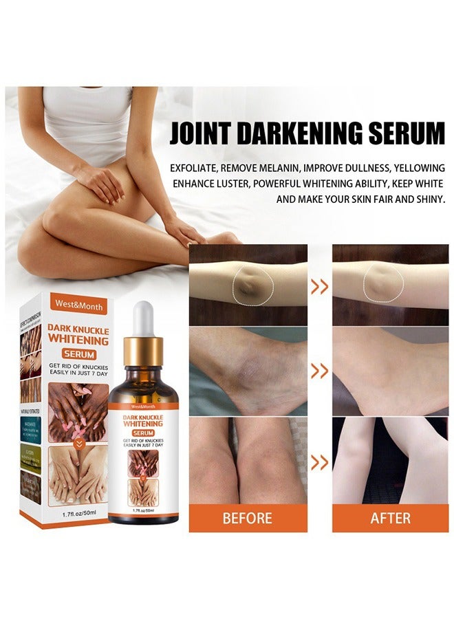 Dark Knuckle Whitening Serum-Restoring Hand Treatment, Moisturizing, Exfoliates and Reduces Unbalanced Pigmentation, for Removing Dark Knuckle Elbow, Brighter, Firmer Skin