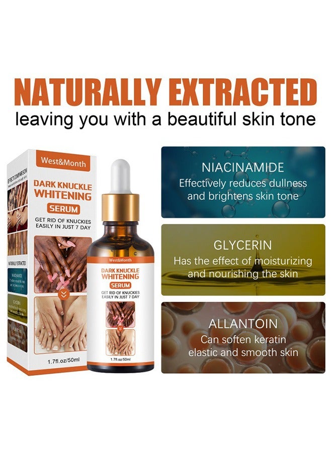 Dark Knuckle Whitening Serum-Restoring Hand Treatment, Moisturizing, Exfoliates and Reduces Unbalanced Pigmentation, for Removing Dark Knuckle Elbow, Brighter, Firmer Skin