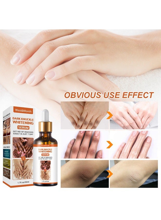 Dark Knuckle Whitening Serum-Restoring Hand Treatment, Moisturizing, Exfoliates and Reduces Unbalanced Pigmentation, for Removing Dark Knuckle Elbow, Brighter, Firmer Skin